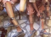 Полиомиелит: риск заражение болезнью, осложнение 