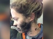 У австралийки во время полета в самолете взорвались наушники (Видео)