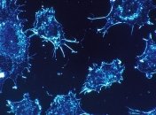 Лечит сама природа: названо вещество, убивающее онкологию