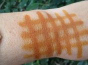 Йодная сетка: в каких случаях она помогает