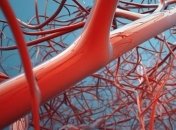 Как чистить сосуды в домашних условиях быстро и эффективно