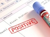 В Украине за три года число ВИЧ-положительных увеличилось более чем на 5 тыс. человек