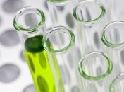 В Украине возросло количество подозрений на коронавирус