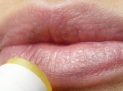 Губы человека могут рассказать о его здоровье