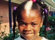 Эту девушку в детстве обзывали скунсом, но она выросла и стала моделью (Фото)