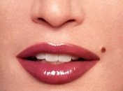 Родинки - признак долголетия