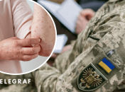 З якими хворобами шкіри не мобілізують