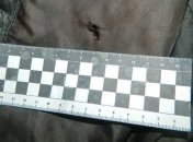 В результате стрельбы в Киеве умер молодой человек