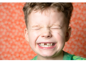 Настоящие причины кариеса у детей