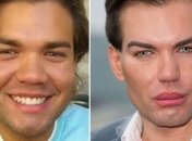 "Реальный Кен" показал, как он выглядел до своих 58 пластических операций (Фото)