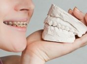 Как можно исправить неправильный прикус?