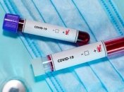 "Лжецы!" Украинцы горячо обсуждают ситуацию с кислородом и заболеваемостью COVID-19 в Украине