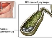 Эти два продукта эффективны для профилактики от камней в желчном пузыре