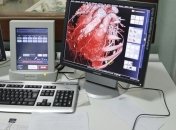 Ученые из США вырастили трехмерную сердечную мышцу