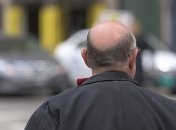 Виновата лысина? Какая категория мужчин чаще страдает от рака простаты 