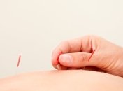 Акупунктура помогает облегчить симптомы аллергии