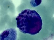 Ученые определили новый способ борьбы с вирусными инфекциями