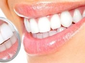 Предотвратите развитие кариеса в домашних условиях 