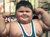 Детское ожирение приводит к образованию желчных камней