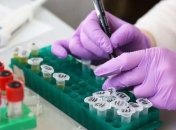 За добу на Буковині від коронавірусу померли три людини