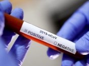 Перший випадок зараження коронавірусом зафіксовано у Молдові 