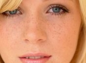 Как избавиться от веснушек в домашних условиях