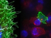 Ученые сняли на видео атаку Т-киллеров на раковые клетки