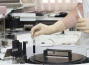 В Киеве наблюдается увеличение заболеваний менингококковой инфекцией