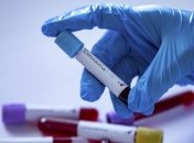 Австрійська компанія заявляє, що винайшла найшвидший у світі тест на коронавірус