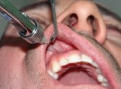 Ученые разработали анестезию без уколов 