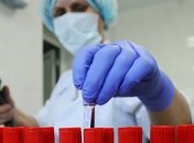 Київ утримує сумне лідерство: в Україні виявлено майже 10 тисяч нових випадків COVID-19