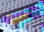 Лаборатории в Украине делают некачественные тесты на COVID-19: детали