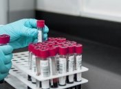 У запорізькому гуртожитку виявили одинадцятьох хворих на коронавірус