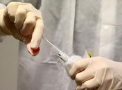 Во Львовской области за сутки COVID-19 выявили у 171 человека