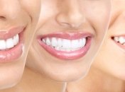 Как удалить зубной камень в домашних условиях