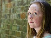 Учимся быстро и эффективно убирать веснушки 