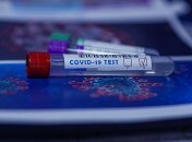 Частные лаборатории не будут делать бесплатные тесты на коронавирус всем подряд: как это будет работать