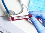 Коронавирус в Украине: сколько человек заразились COVID-19, данные МОЗ