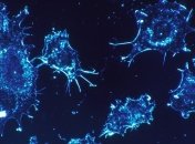 Раковые клетки способны соединятся с нейронами головного мозга