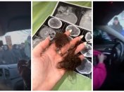 У Космачі постраждали троє людей