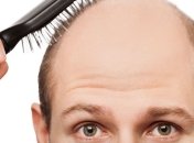 Как справиться с ранним облысением?