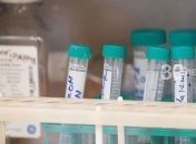 У Києві за добу зафіксували "вражаючу" кількість інфікованих