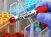 Прогресс в борьбе с коронавирусом под угрозой: озвучена неутешительная правда о штамме "Дельта"