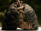 Легкие доноров-курильщиков пригодные для пересадки