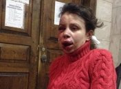 Татьяна Черновол поделилась своим мнением о том, почему ее избили