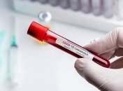 В Украине увеличилось число смертей от коронавируса