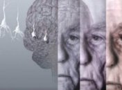 Ученые разработали лекарство нейростатин от болезни Альцгеймера