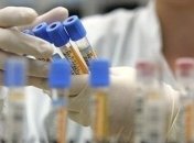  Коронавірус: в Україні знову майже дві тисячі хворих і новий антирекорд смертей