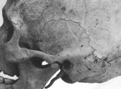 Ученые: Леворукость связали с прикусом и риском туберкулеза