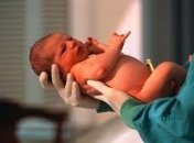 Недоношенным детям грозят неврологические нарушения